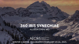 360 Iris Synechiae